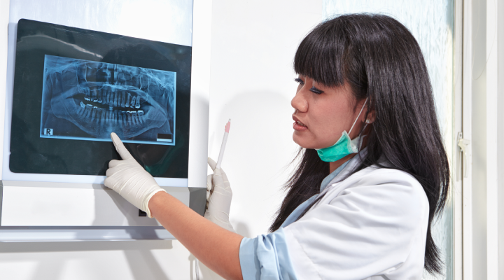 What Is Apicoectomy? | Dental Procedure Explained