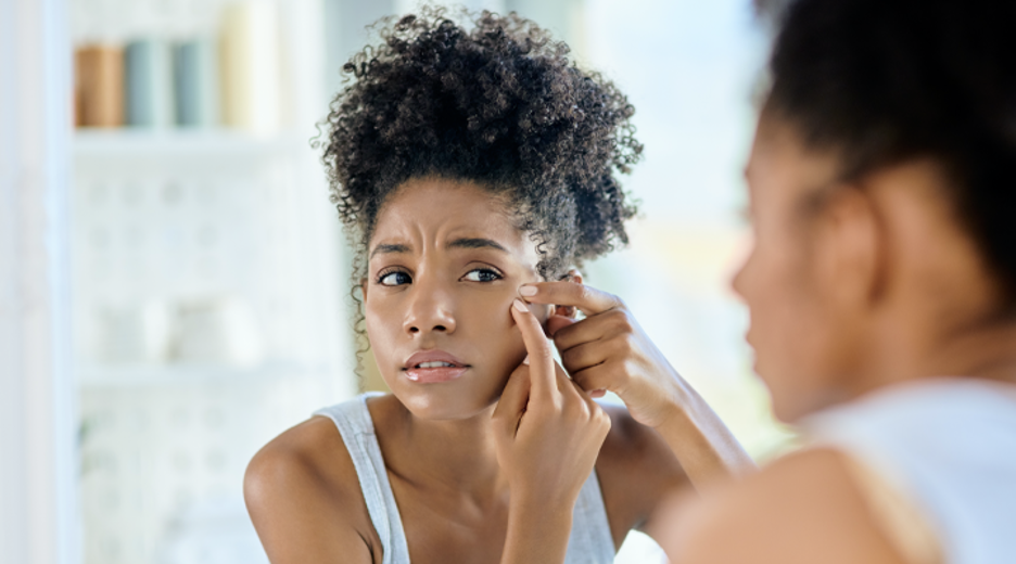 Blemish Control: Is Toothpaste for Acne Effective? - Hawaii Dental ...