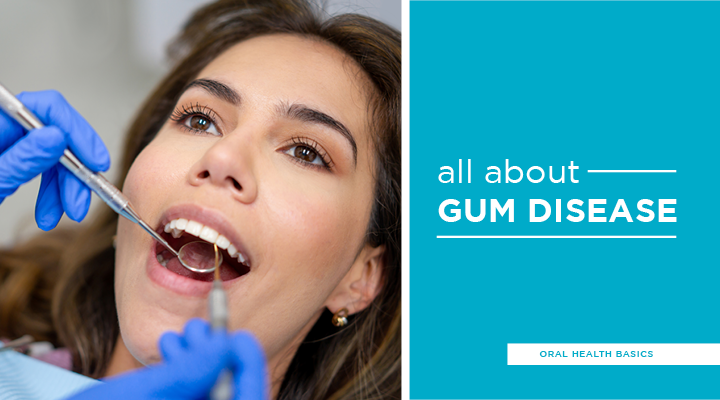 Oral Health Basics: All About Gum Disease - Hawaii Dental Service Blog